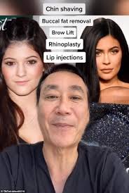 Getting lip fillers is one of the many ways kylie jenner likes to pamper herself. Khloe Kardashian Ariana Grande Bella Hadid Kendall Jenner A Surgeon Balances All Celebrity Cosmetic Operations News24viral