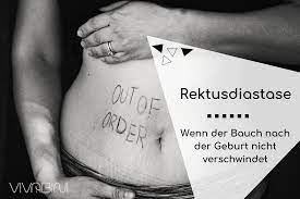 Zwar ist die gebärmutter nach etwa sechs wochen wieder zurückgebildet, der körper hat deshalb meist aber trotzdem noch nicht die alte figur erreicht. Rektusdiastase Wenn Der After Baby Bauch Nicht Weg Geht Vivabini