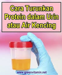 Lalu, bagaimana cara menyembuhkan sakit pinggang sakit pinggang atau biasa disebut juga dengan nyeri punggung bagian bawah merupakan hal yang normal terjadi, baik pada pria maupun wanita. Account Suspended Info Protein Personal Care