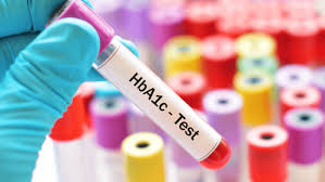 Hba1c A Test Every Diabetic Should Know About The Wellthy