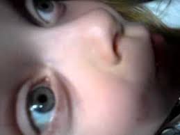 Learn more at boston children's hospital. I Am Katie Wells Youtube