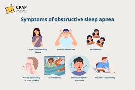 Image result for Obstructive Sleep Apnea