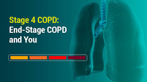 We did not find results for: Stage 4 Copd End Stage Copd And You Lung Health Institute