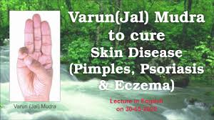 So you should look for getting relaxation and calmness. Varun Jal Mudra To Cure Skin Disease Pimples Psoriasis Eczema By Jitendra Mistry In English Youtube