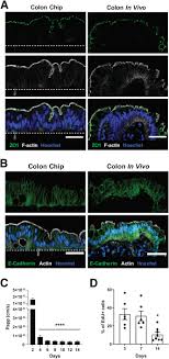 Matter in the plasma state has variable volume and shape. Human Colon On A Chip Enables Continuous In Vitro Analysis Of Colon Mucus Layer Accumulation And Physiology Abstract Europe Pmc