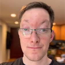 How did I capture a ketchup brand's Super Bowl audience with a single typo  and $15?