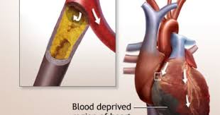 Pin On Human Body The Heart