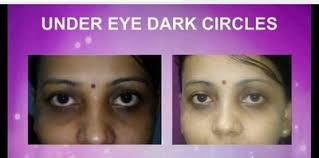 Sebenernya, keluhan ini udah lumayan lama. Glow Skin White Glow Skin White