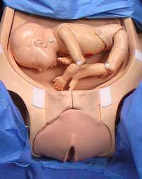 Transverse Breech Low Kicking Anyone Babycenter