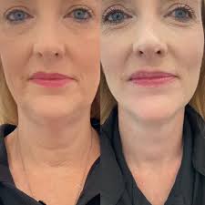 Wellspring Medical Spa & Aesthetics