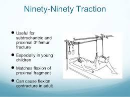 Preoperative traction for hip fractures was still in use in the three hospitals, mainly applied by experienced surgeons for subtrochanteric fractures. Application Of Traction In Orthopaedics