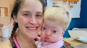 Child Battling One of the Rarest Fatal Diseases in the World