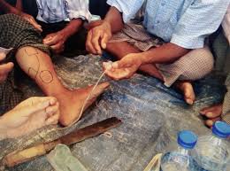Snakes are remarkable animals, successful on land, in the sea, in forests, in grasslands, in lakes, and in deserts. Why Snakebite Patients In Myanmar Seek Traditional Healers Despite Availability Of Biomedical Care At Hospitals Community Perspectives On Reasons