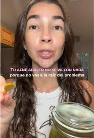 Acne adulto Piel madura con acné Recetas naturales para el acné My acn...