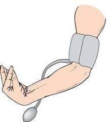 An indication of bodily condition that can be directly perceived (as by auscultation) by an examining physician. Trousseau S Sign Definition Of Trousseau S Sign By Medical Dictionary Medical Dictionary Medical Terms Family Wellness