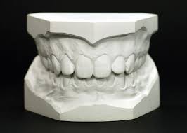 Check spelling or type a new query. Plaster Of Paris Definition Uses History Britannica