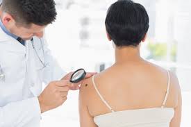 Ümental condition ümucosae color, skin color. Charlotte Mohs Surgeon Services In Skin Cancer Treatment
