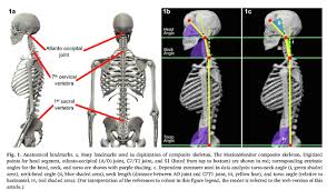 Learn more about head and neck anatomy, including the top part of the skeleton, muscles, and more with our digital flashcards. New Research On The Head Neck Back Relationship Alexander Technik Studio