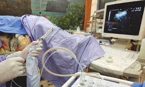 One that serves as a substitute. Surrogacy Procedure Not Available At Home Despite Demand Newspaper Dawn Com