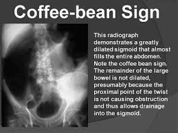 Coffee Bean Sign Medical Laboratory Science Radiology Imaging Medical Studies