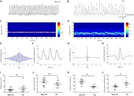 Frontiers Alzheimers Transgenic Model Is Characterized By