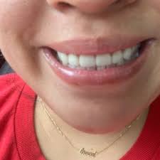 They all explain the plan of care very clearly. Apex Dental Care 23 Reviews General Dentistry 3565 Lee Hwy Arlington Va Phone Number