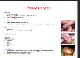 Image result for Penile Cancer