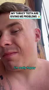 Funny Turkey Kommersial New Hair and Teeth