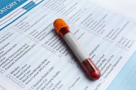 If the test is positive, it is with 99.9% confidence. Top 10 Blood Tests For Older Adults What To Know