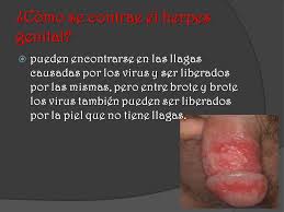 Este tipo de enfermedades está englobada dentro de las denominadas infecciones de transmisión sexual y puede afectar tanto a hombres como a mujeres. Infecciones De Transmision Sexual Ppt Video Online Descargar