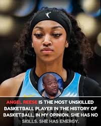 Who rocks the unibrow or upper lip better?