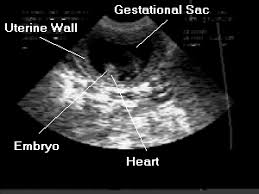 Here's more on fetal heart rate and when you'll hear baby's heartbeat. Canine Pregnancy East Central Veterinary Hospital Wichita Ks