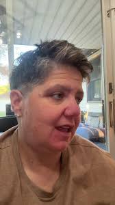 Funny Mole Removal Reaction: Hilarious Moment