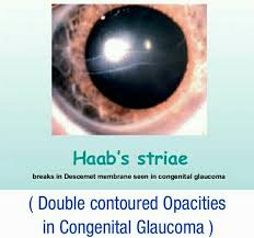 Pin On Eye Dots Spots Lines