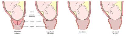 Pin On Labor Birth Support Tips From Doulas Midwives And Educators