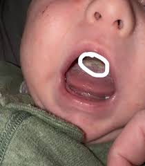 of 80 0 Not ዉ Pregnant NotPreg Pregr B0 NotPregnant Not Not Pregnant  Pregnant ዉ