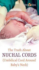 Pin On Childbirth Education