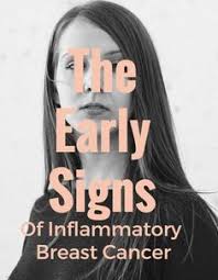 Symptoms of inflammatory breast cancer can include: Green Breast