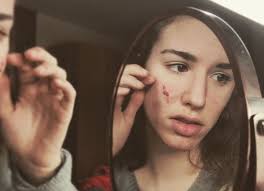 5 Things I Want My Future Partner To Know About My Skin Picking Disorder Skin Picking Disorder Dermatillomania Disorders