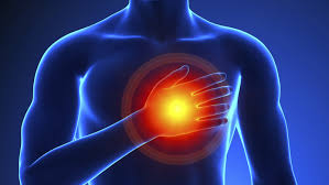 Sudden cardiac arrest (sca) is a condition in which the heart suddenly stops beating. Many Men With Sudden Cardiac Arrest Had Early Warnings