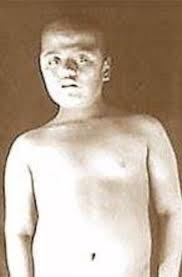 La curiosa historia del “niño lobo” chileno cumple 70 años