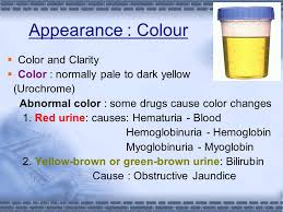 Urinalysis Ppt Video Online Download