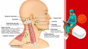 Atunci când devin inflamați pot ascunde o problemă serioasă. Ganglionii InflamaÈ›i La Copii Ce Boli SemnaleazÄƒ È™i Cand Trebuie SÄƒ Mergi La Medic Dr Cristiana Orodel