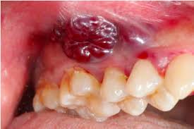 Pin On Oral Surgeon Cosmetics