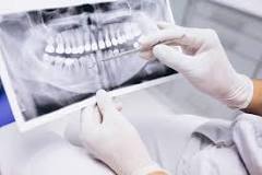 Image result for what does a dentist forum mean by are you under medical treatment