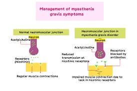 Image result for Cholinergic Toxicity