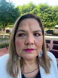 Toma de rectoría en la UAdeO Culiacán desata enfrentamiento