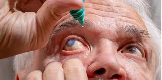 Katarak merupakan penyakit mata yang ditandai dengan mengeruhnya lensa mata, sehingga membuat penglihatan kabur. Pembedahan Katarak Adalah Sangat Selamat Untuk Dijalani Hello Doktor