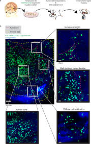 The pathologist looks at slides of the tumor under the microscope to see how close the cancer cells get to the ink (the edges or margins of the specimen). Intravital Imaging Of Glioma Border Morphology Reveals Distinctive Cellular Dynamics And Contribution To Tumor Cell Invasion Scientific Reports