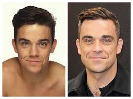 Robbie Williams